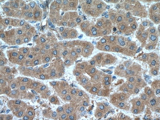 [14986-1-AP-20UL] MGLL Polyclonal antibody