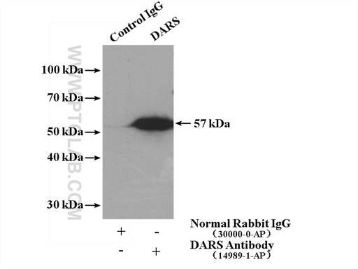 [14989-1-AP-20UL] DARS Polyclonal antibody