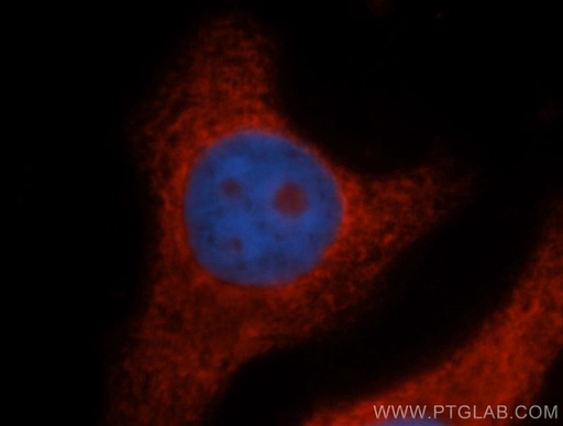 [14991-1-AP-20UL] RPL14 Polyclonal antibody