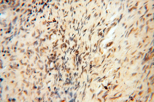 [14992-1-AP-150UL] HIRIP3 Polyclonal antibody