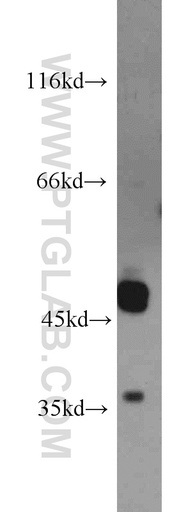 [15000-1-AP-20UL] UNKL Polyclonal antibody