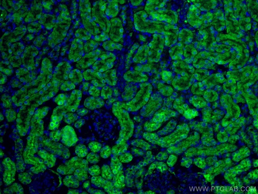[15003-1-AP-20UL] RENALASE Polyclonal antibody