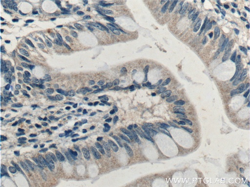 [15005-1-AP-20UL] PRSS2 Polyclonal antibody