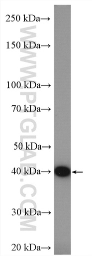 [15008-1-AP-150UL] HLA-E Polyclonal antibody