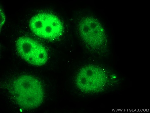 [15010-1-AP-20UL] SKP2 Polyclonal antibody