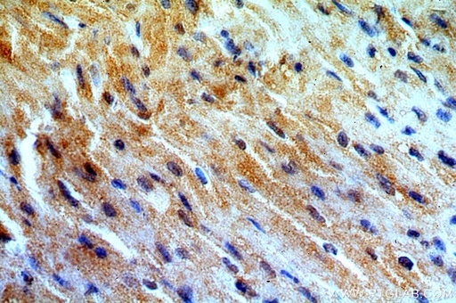 [15012-1-AP-150UL] MYO1B Polyclonal antibody