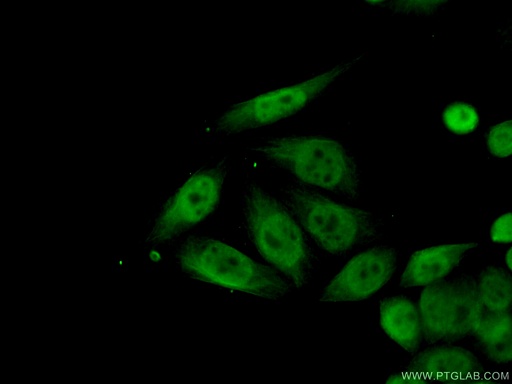 [15030-1-AP-20UL] CUTC Polyclonal antibody