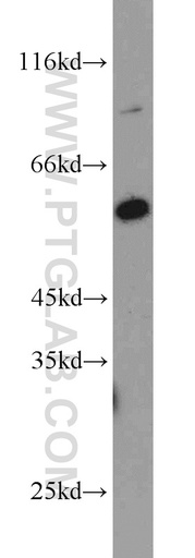 [15032-1-AP-150UL] PHF17 Polyclonal antibody