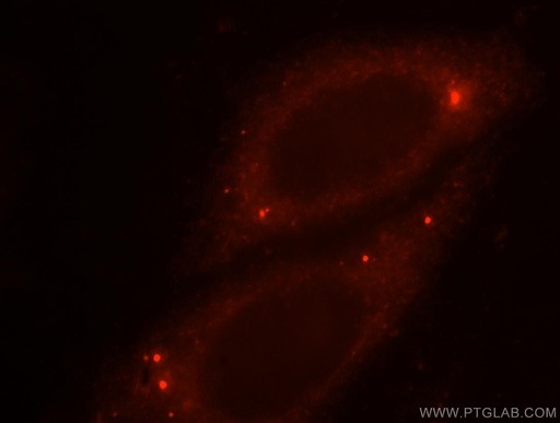 [15033-1-AP-20UL] OSGEP Polyclonal antibody