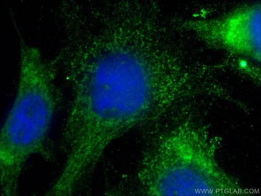 [15036-1-AP-150UL] HAI-1 Polyclonal antibody