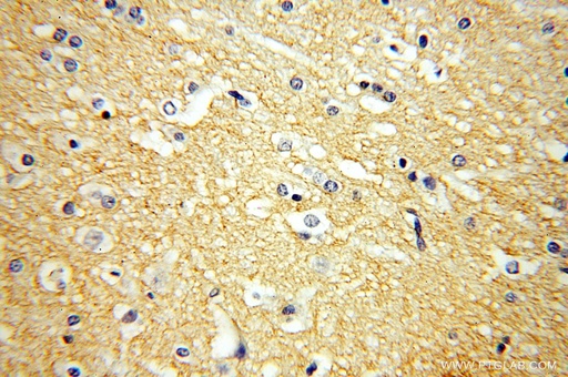 [15044-1-AP-150UL] GPM6A Polyclonal antibody