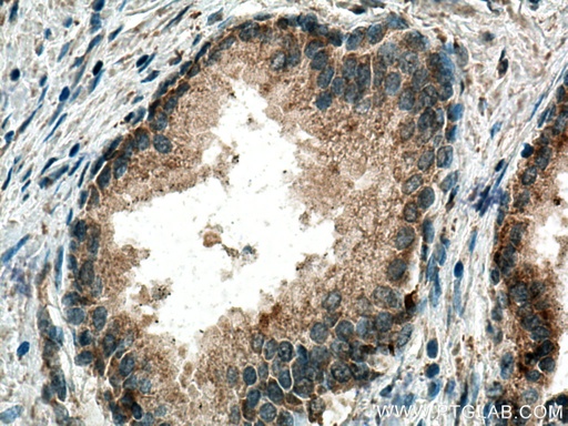 [15052-1-AP-20UL] SMOX Polyclonal antibody