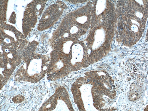 [15056-1-AP-150UL] NUPR1 Polyclonal antibody