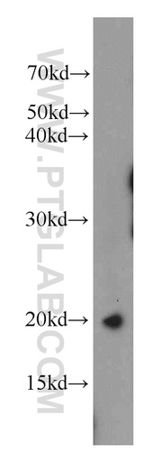 [15057-1-AP-150UL] TPPP3 Polyclonal antibody