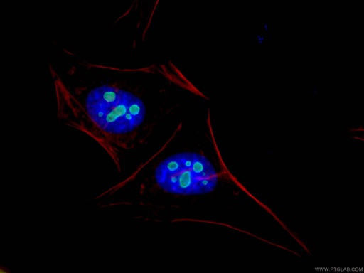 [15060-1-AP-150UL] GNL3 Polyclonal antibody