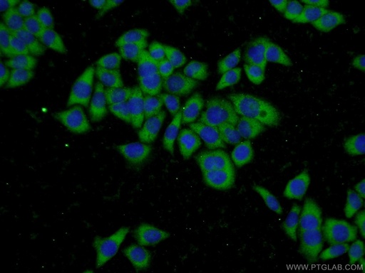 [15063-1-AP-150UL] GSTT2 Polyclonal antibody