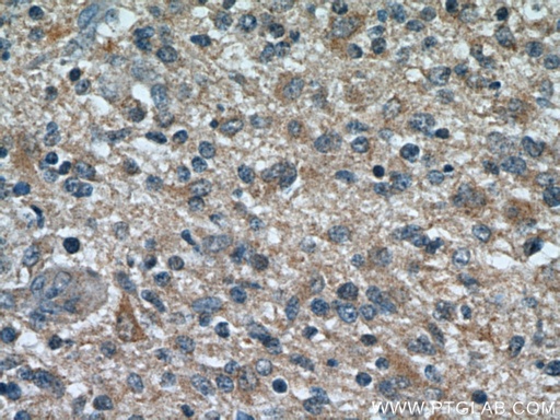 [15071-1-AP-150UL] TOMM7 Polyclonal antibody