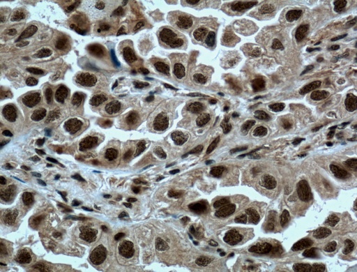 [15073-1-AP-150UL] METTL3 Polyclonal antibody