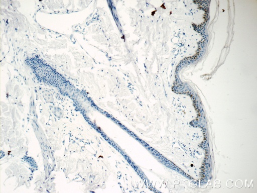 [15076-1-AP-150UL] C7orf49 Polyclonal antibody
