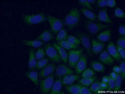 [15077-1-AP-150UL] HPS1 Polyclonal antibody