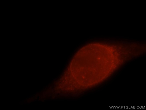 [15080-1-AP-20UL] POLDIP2 Polyclonal antibody