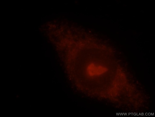 [15081-1-AP-150UL] PDAP1 Polyclonal antibody