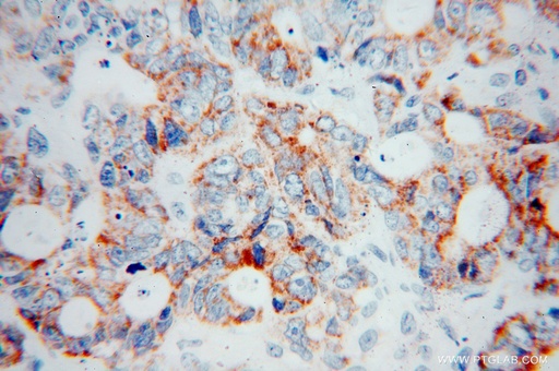 [15083-1-AP-20UL] COQ7 Polyclonal antibody