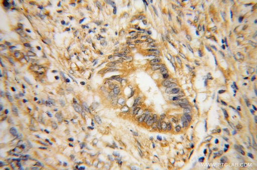 [15085-1-AP-20UL] RPS19 Polyclonal antibody