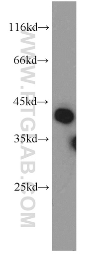 [15088-1-AP-20UL] RIMS3 Polyclonal antibody