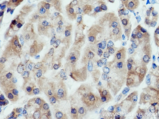 [15092-1-AP-150UL] ALG2 Polyclonal antibody