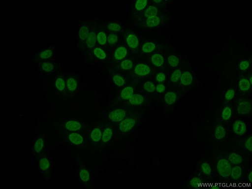 [15093-1-AP-20UL] SCML1 Polyclonal antibody