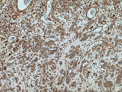 [15097-1-AP-150UL] ATP6V1B2 Polyclonal antibody