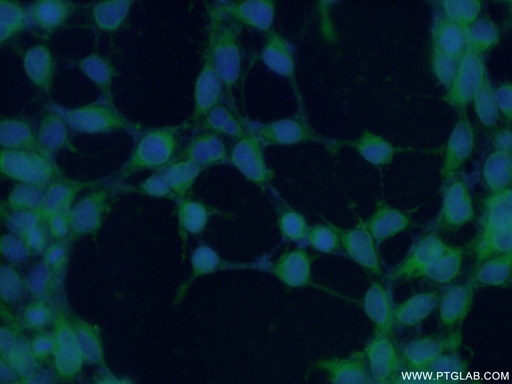 [15098-1-AP-20UL] INPP5K Polyclonal antibody