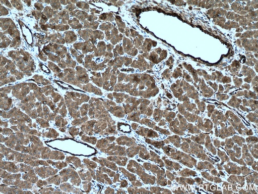 [15100-1-AP-20UL] TGM2 Polyclonal antibody