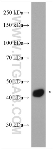 [15102-1-AP-150UL] IL-10RB Polyclonal antibody