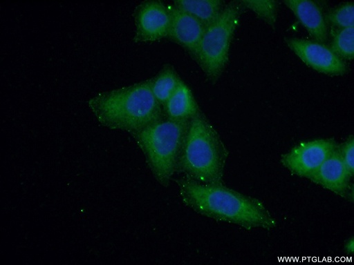 [15111-1-AP-150UL] NSDHL Polyclonal antibody