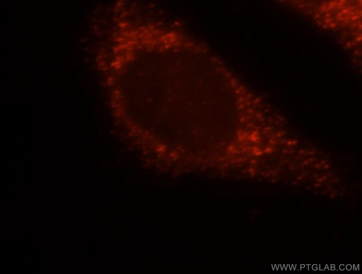[15116-1-AP-150UL] HSD17B4 Polyclonal antibody