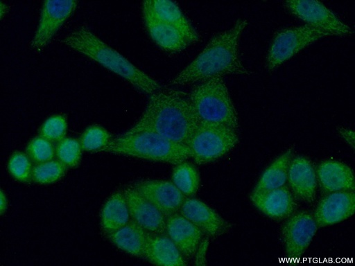 [15118-1-AP-20UL] HCCS Polyclonal antibody