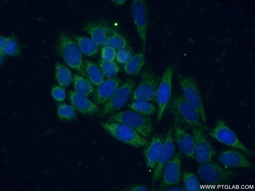 [15122-1-AP-150UL] SIRT5 Polyclonal antibody