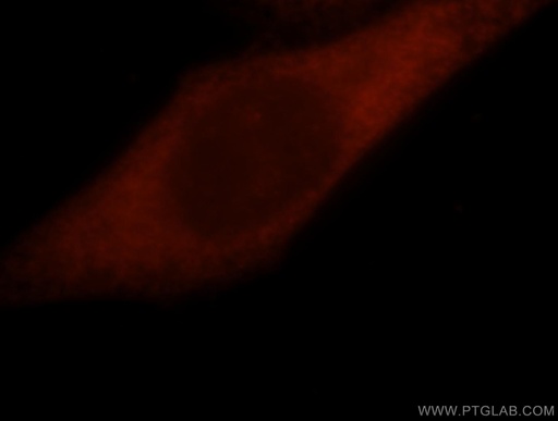 [15124-1-AP-150UL] GSTO1 Polyclonal antibody