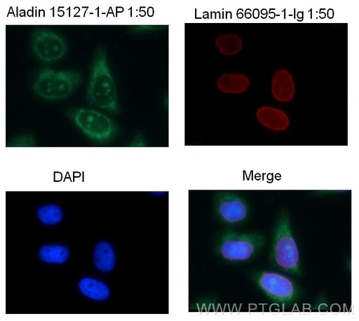 [15127-1-AP-150UL] ALADIN Polyclonal antibody