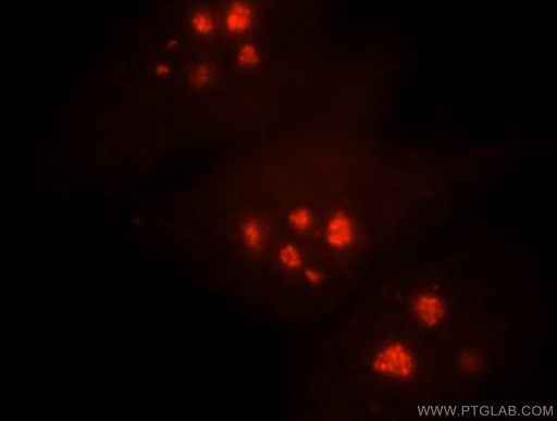 [15128-1-AP-20UL] NHP2 Polyclonal antibody