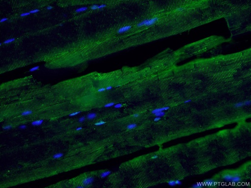 [15129-1-AP-20UL] ABLIM1 Polyclonal antibody