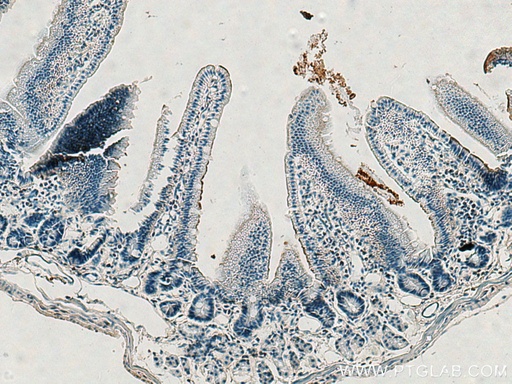 [15130-1-AP-20UL] Villin Polyclonal antibody