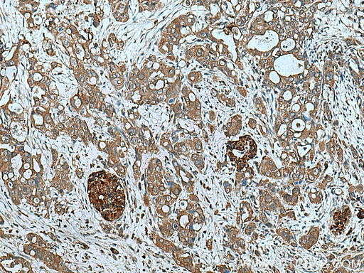[15131-1-AP-20UL] ATG4B Polyclonal antibody