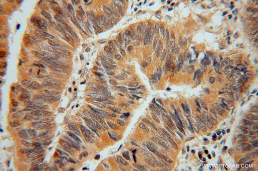 [15133-1-AP-20UL] ADI1 Polyclonal antibody