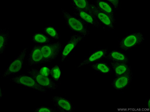 [15134-1-AP-150UL] HDGF2 Polyclonal antibody