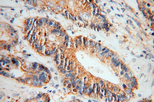[15137-1-AP-20UL] CKB/CKM Polyclonal antibody