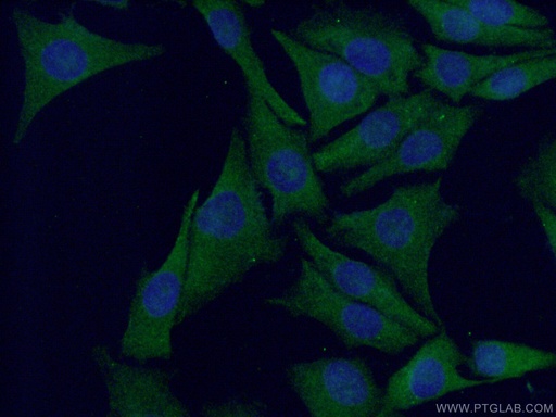 [15146-1-AP-150UL] S100 Beta Polyclonal antibody