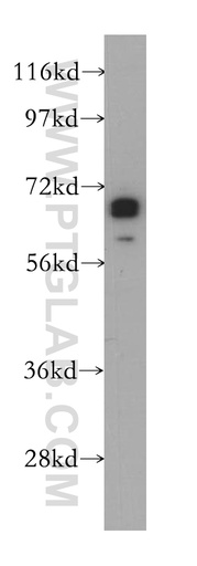 [14529-1-AP-150UL] ZNF410 Polyclonal antibody